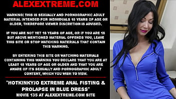 Hotkinkyjo extreme anal fisting & prolapse in blue dress