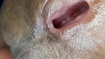 Uretra do pene em close up